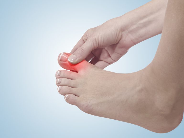 cbd for gout